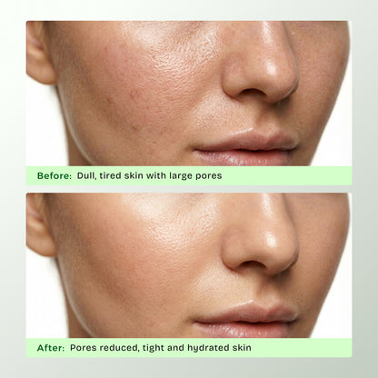 Pore Reset Clay Mask | For Oily & Sensitive Skin