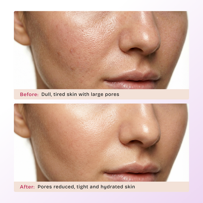 Dewy Detox Clay Mask | For Dry & Sensitive Skin